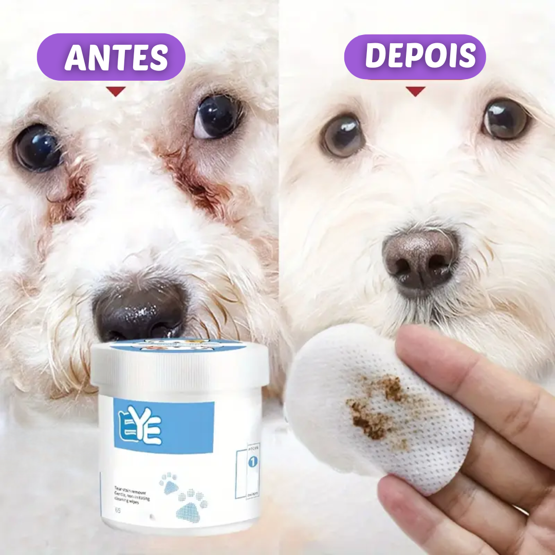 Kit Fim da Lágrima Ácida – Limpeza Profunda, Hidratação Suave e Prevenção Eficaz