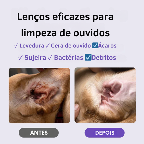 Lenços umedecidos para a Limpeza de Orelhas